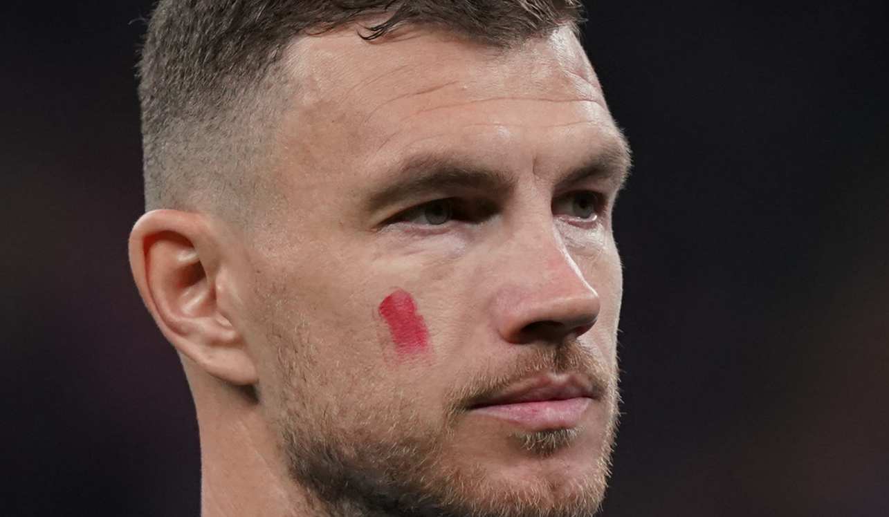 dzeko 